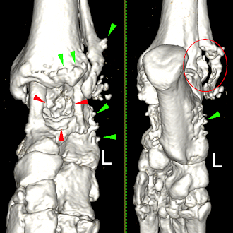 Master CT Imaging - Join our FREE expert-led webinars